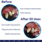 TEEF Protektin42 Dental Powder | Natural Prebiotic Dental Water Additive